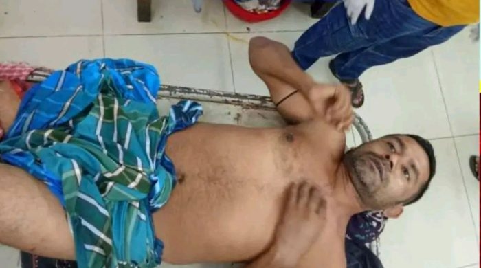 বরিশালে প্রকাশ্যে ছাত্রদলের সাবেক নেতাকে কুপিয়ে জখম